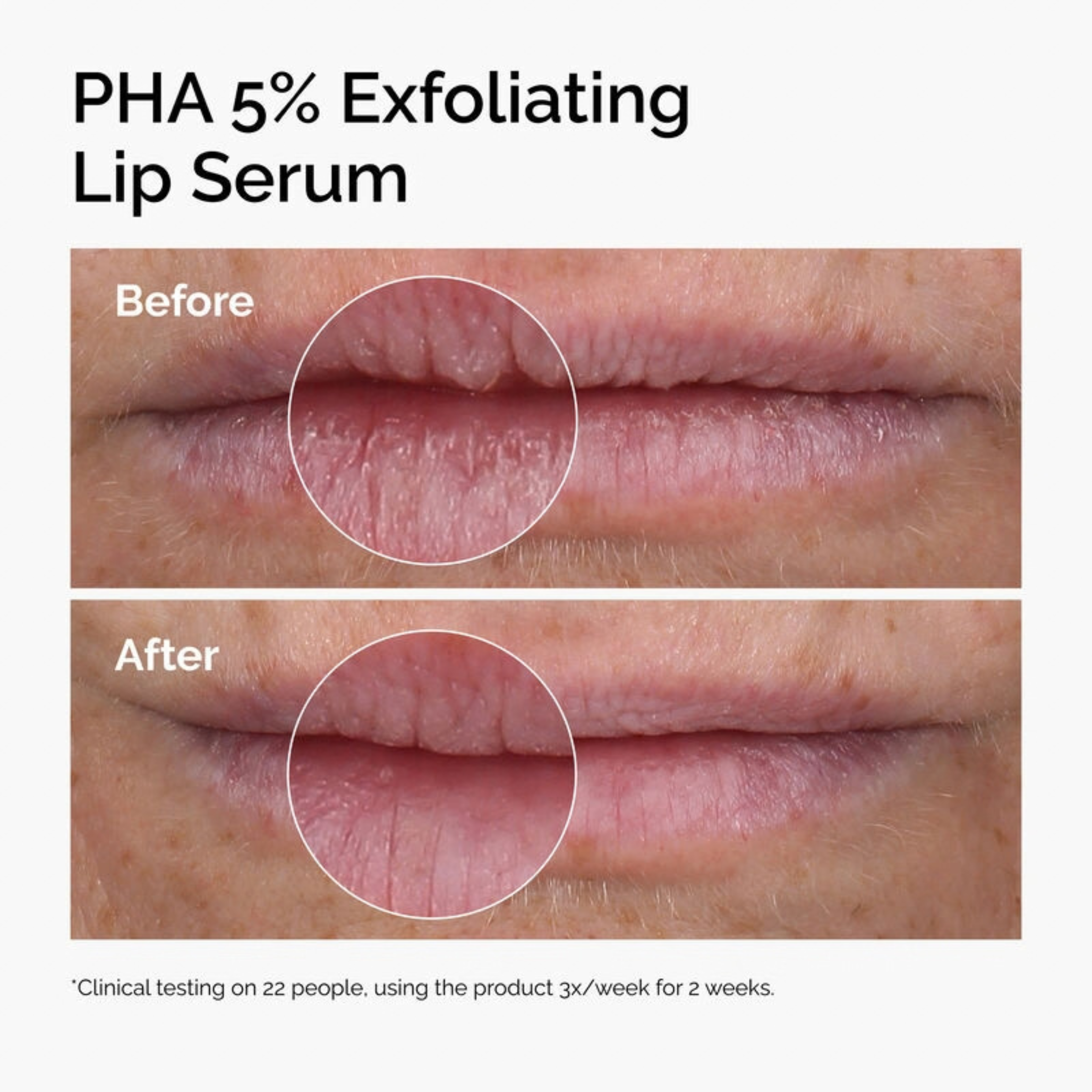 PHA 5% Exfoliating Lip Serum before and after lip texture comparison