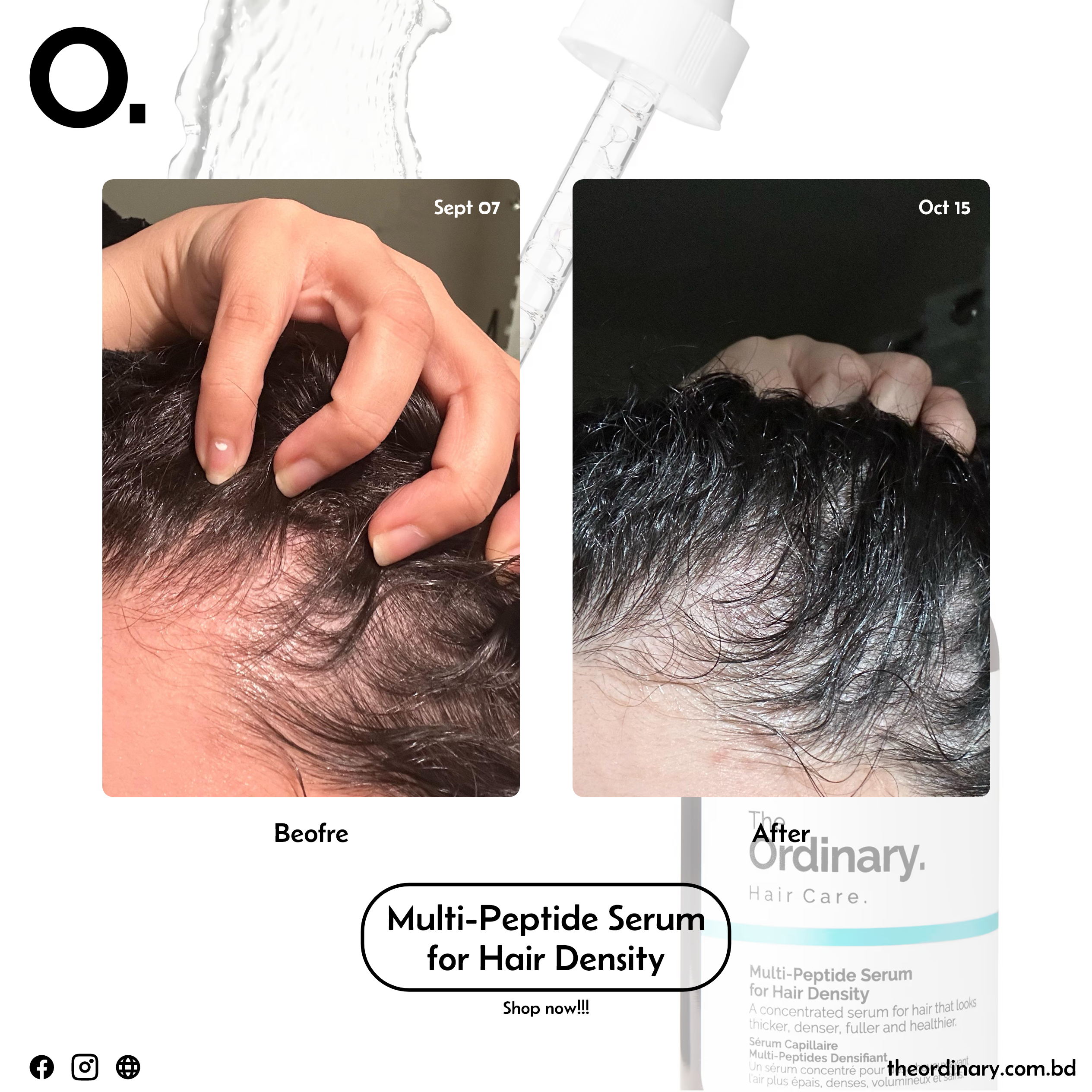 Multi-Peptide Serum for Hair Density