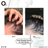 Multi-Peptide Serum for Hair Density